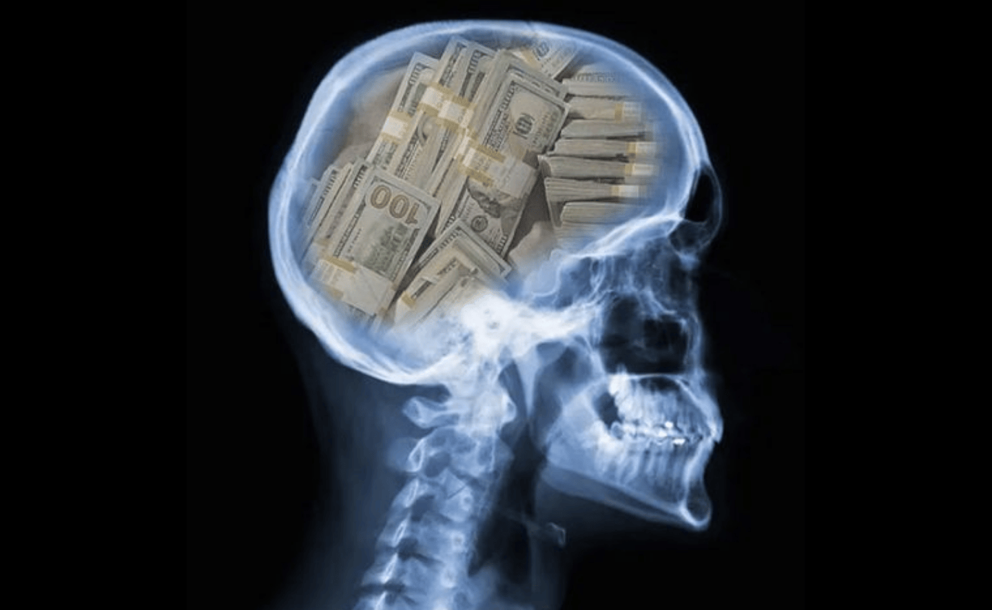 Lo lắng về tiền bạc có thể làm rối loạn suy nghĩ của bạn