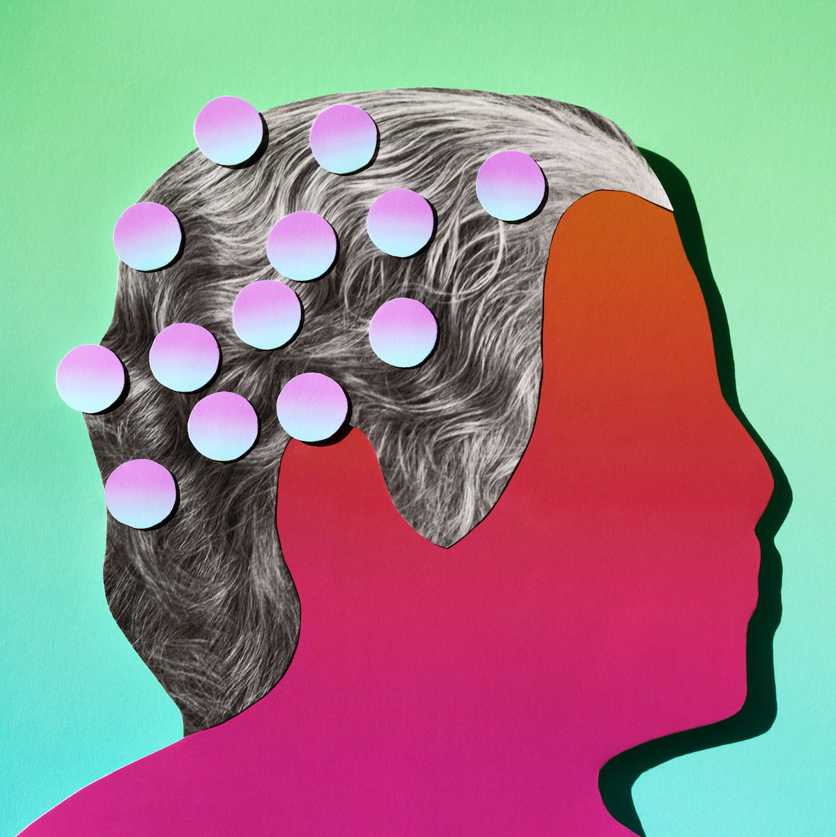 Nên và không nên làm gì nếu thấy người thân có dấu hiệu đột quỵ não?